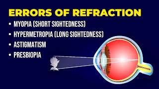 Errors of Refraction  Myopia  Hypermetropia  Astigmatism  Presbiopia  Short amp Long Sightedness [upl. by Blodgett]