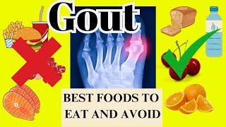 Best and Worst Foods for GOUT ATTACK Foods to EAT and AVOID for high URIC ACID [upl. by Ynattirb]