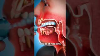 How An Inhaler Works 🤔viral shorts ‎drMaryamGull [upl. by Cthrine]