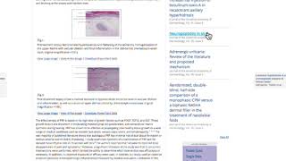 BXO lichen sclerosus in men treatment [upl. by Dallis]