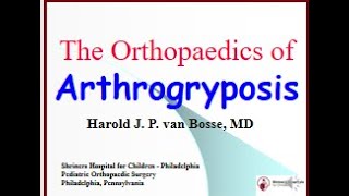 The Orthopaedics of Arthrogryposis by Dr Harold vanBosse [upl. by Boony421]