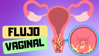 FLUJO VAGINAL  Señales de alerta para infección [upl. by Aeynod]