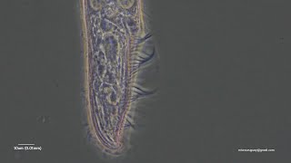 Los cilios de Blepharisma  the Blepharisma cilia [upl. by Qooraf839]