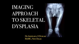 IMAGING APPROACH TO SKELETAL DYSPLASIA Skeletal survey l Types of dysplasia l Xrays l [upl. by Navlys]