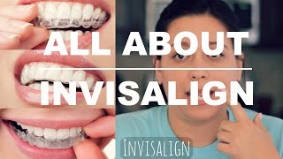 INVISALIGN REVIEW  HOW IT WORKS AND WHAT TO EXPECT [upl. by Arias]