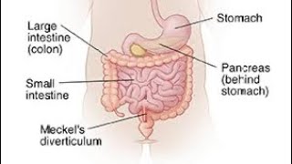 Mcqs on Meckel’s diverticulum surgerysurgeryeducationneetpg [upl. by Myrle]