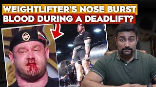 Nose Bleed during Deadlift  What to do [upl. by Beare]