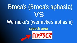 Brocas aphasia vs Wernickes aphasia Brocas vs Wernickes speech area in amharic በአማርኛ [upl. by Mohun841]