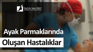 Ayak Parmaklarında Hangi Tür Rahatsızlıklar Olmaktadır [upl. by Ralina]