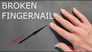 How to fix a broken fingernail for classical guitar and others [upl. by Cannell]