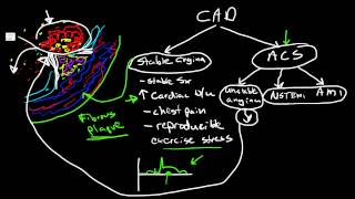 Pathophysiology of Coronary Artery Disease [upl. by Gerdeen359]