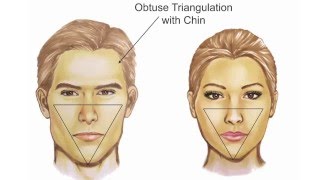 Facial Feminization Systematic Review– Jeffrey H Spiegel MD FACS [upl. by Nnyltiac671]