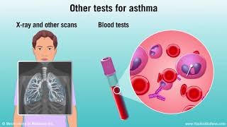 Diagnosing Asthma Mild Moderate and Severe [upl. by Iormina]