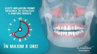 3D medical animation  Fast and Fixed dental implant [upl. by Bradeord]