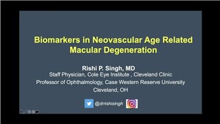 Biomarkers in Neovascular AgeRelated Macular Degeneration [upl. by Nira]