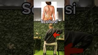 Due esercizi per la scoliosi postura dottvincenzosudi scoliosis [upl. by Kirch]