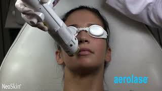 Aerolase® 101 Everything You Need To Know  Weiler Plastic Surgery Group [upl. by Maryl280]