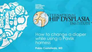 How to change a diaper wearing a Pavlik Harness [upl. by Ahsito]