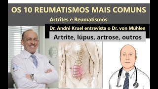 OS 10 REUMATISMOS MAIS COMUNS como diagnosticar e tratar [upl. by Rand]