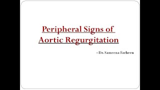 Peripheral signs of Aortic Regurgitation Dr Sameena Farheen [upl. by Ynehpets]