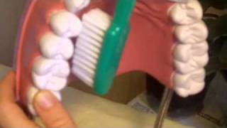 Gum Disease Remedy Receding Gums Treatment [upl. by Sueddaht]