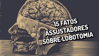 15 fatos assustadores sobre lobotomias [upl. by Ilsel914]