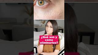 ¿Qué son y cómo eliminarlos👩🏻‍⚕️ salud quistesdemillium dermatologia piel medicina shorts [upl. by Cleasta]