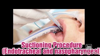 Nasopharyngeal and endotracheal suctioning\\ suctioning procedure [upl. by Gustafsson]