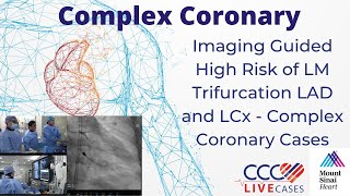 Imaging Guided High Risk of LM Trifurcation LAD and LCx  Complex Coronary Cases  February 19 2019 [upl. by Tybie151]