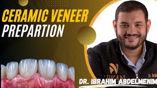 Ceramic veneer preparation  Dr Ibrahim Abdelmunim [upl. by Lam]