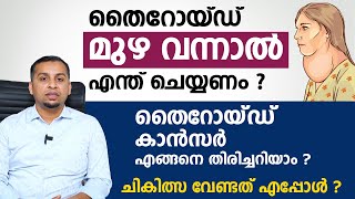 തൈറോയ്ഡ് മുഴ വന്നാൽ എന്ത് ചെയ്യണം  തൈറോയ്ഡ് കാൻസർ എങ്ങനെ തിരിച്ചറിയാം  Thyroid Goiter [upl. by Swartz]