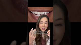 Do you have translucent teeth This video is for you teethwhitening clearteeth translucentteeth [upl. by Kernan]