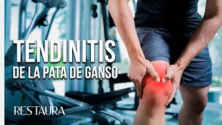 Tendinitis de la pata de ganso [upl. by Gitt]