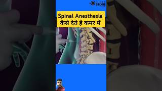 Spinal Anesthesia kaise dete hai anesthisa mbbs knowledge science shorts [upl. by Dis984]