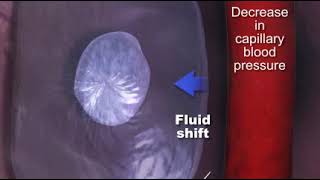 Capillary Blood Pressure quotCBPquot [upl. by Adnovay]