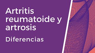 Diferencias entre artrosis y artritis reumatoide Casos prácticos [upl. by Jessy110]