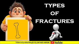 FRACTURE  Types of Fracture  Made Easy for Nurses [upl. by Leahkim]