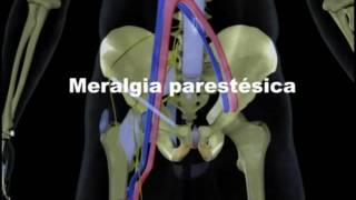 Meralgia Parestésica [upl. by Grounds277]