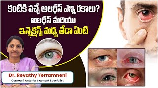 Conjunctivitis Causes Symptoms and Treatment  Types of Eye Infections  Smart Vision Eye Hospital [upl. by Iclek]