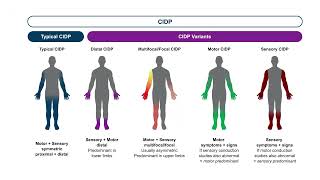 Optimizing Outcomes in CIDP Honing Diagnostic Accuracy Personalizing Treatment Plans [upl. by Zippora]