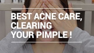 The Best ACNE Care Tips for Clearing Pimple with Eunices naked face XD  Wishtrend [upl. by Areem]