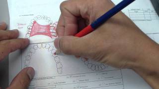 Watch this before you get a partial denture What you need to know Partials Explained [upl. by Randell358]