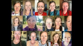 Strabismus Surgery First 3 Months Recovery Expectations [upl. by Iveel589]