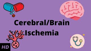 CerebralBrain Ischemia Causes Signs and Symptoms Diagnosis and Treatment [upl. by Nileuqay]