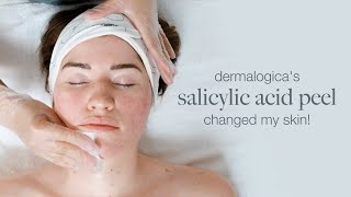 Dermalogica s Salicylic Acid peel changed my skin [upl. by Ahsircal]