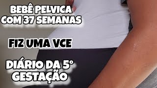 DIARIO DA 5° GRAVIDEZ ‐ MELISSA RESOLVEU SENTAR COM 37 SEMANAS  VCE  36 Á 38 SEMANAS [upl. by Delaney]