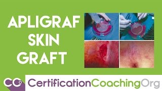 What is Apligraf  Medical Coding for Apligraf Skin Graft Procedures [upl. by Clovah]