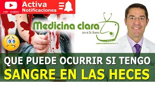 Sangre en las heces sangre con la deposición Enfermedades asociadas  Medicina Clara [upl. by Keefe]