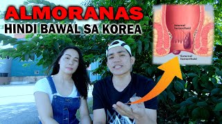 ALMORANAS o Hemorrhoids PEDENG PEDE SA KOREA  paano gamutin  AJ PAKNERS [upl. by Billmyre]