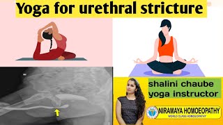 urethral stricture yoga session 23nd june 2022 [upl. by Cattima]